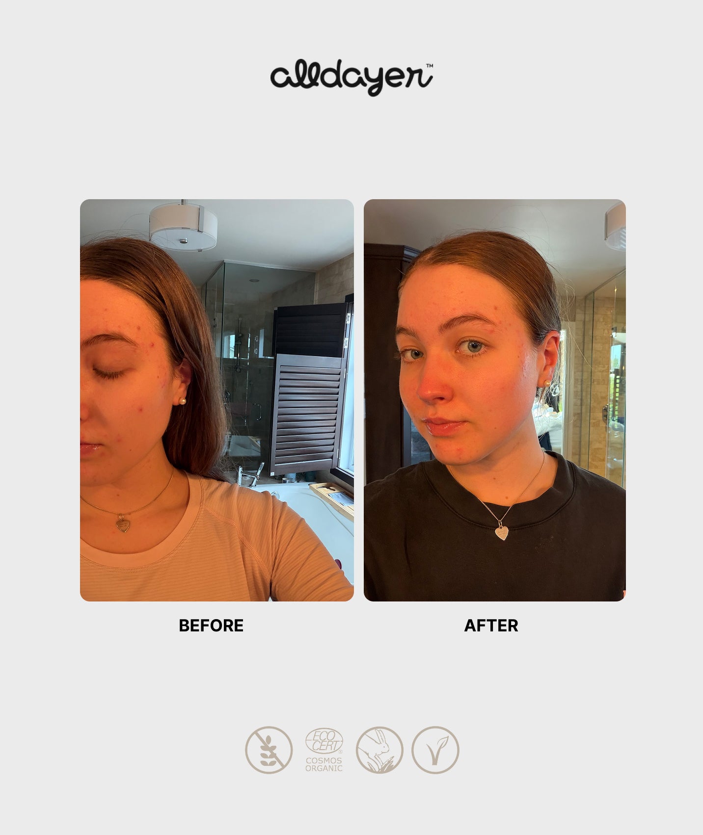 Image of kit habitudes de peau